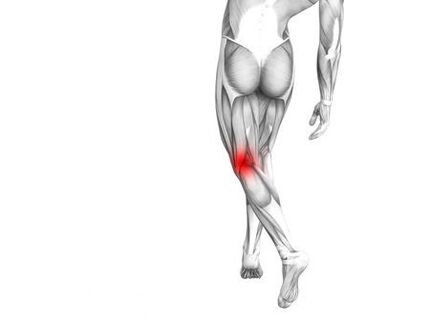 Arthrose des Kniegelenks