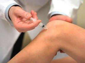 wie man Arthrose des Kniegelenks behandelt