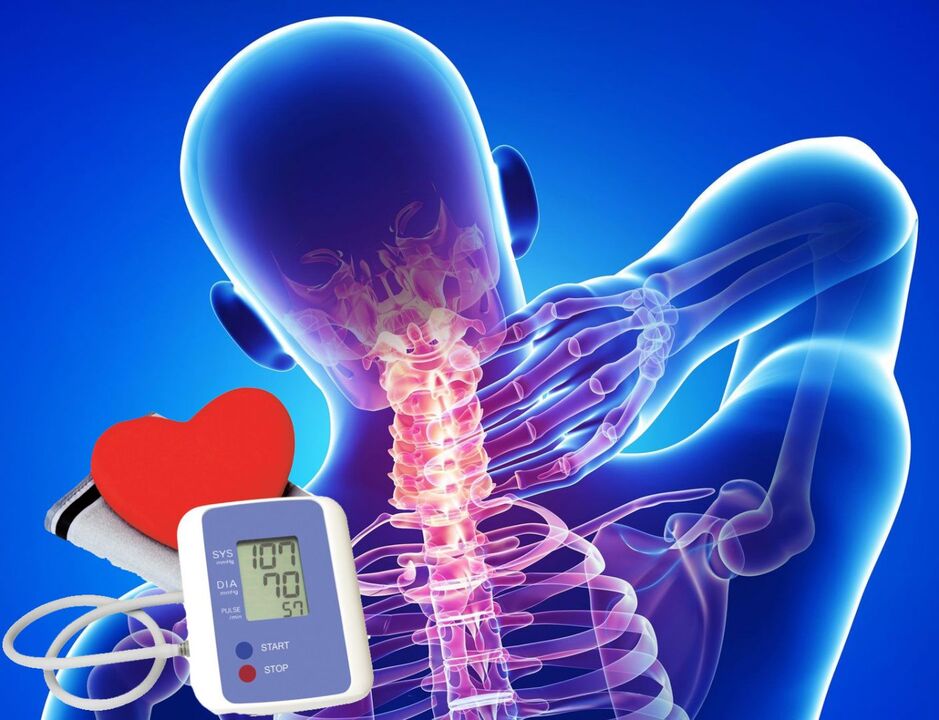Beuchten des Blutdrucks für zervikale Osteochondrose