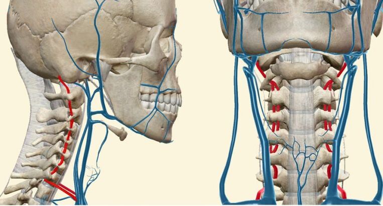 Gefäßsyndrom bei Osteochondrose