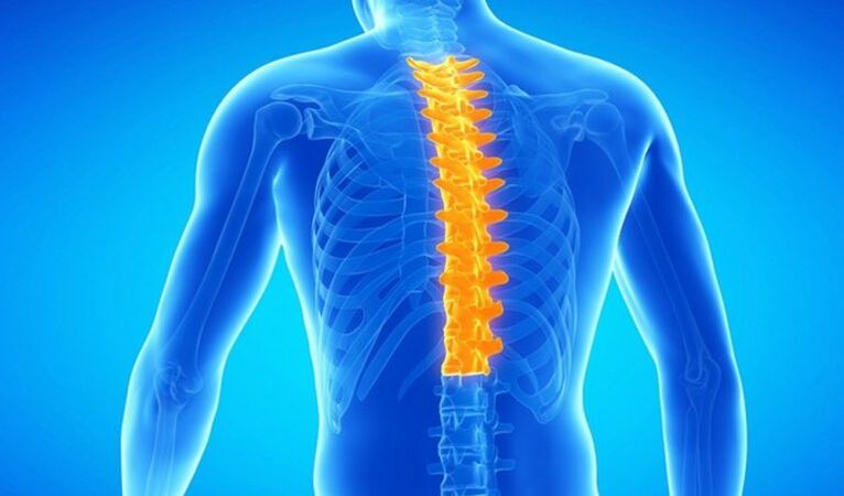 Osteochondrose der Brustwirbelsäule