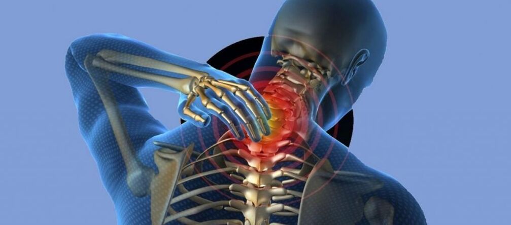 Osteochondrose der Halswirbelsäule