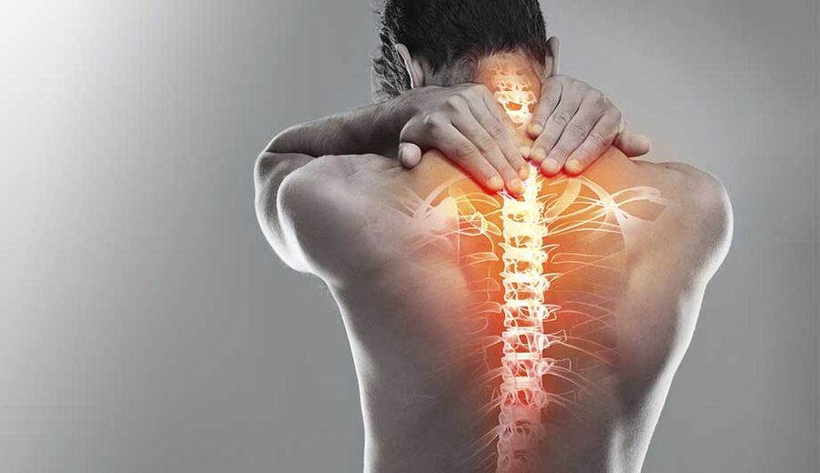 Schmerzen in der Wirbelsäule aufgrund von Osteochondrose